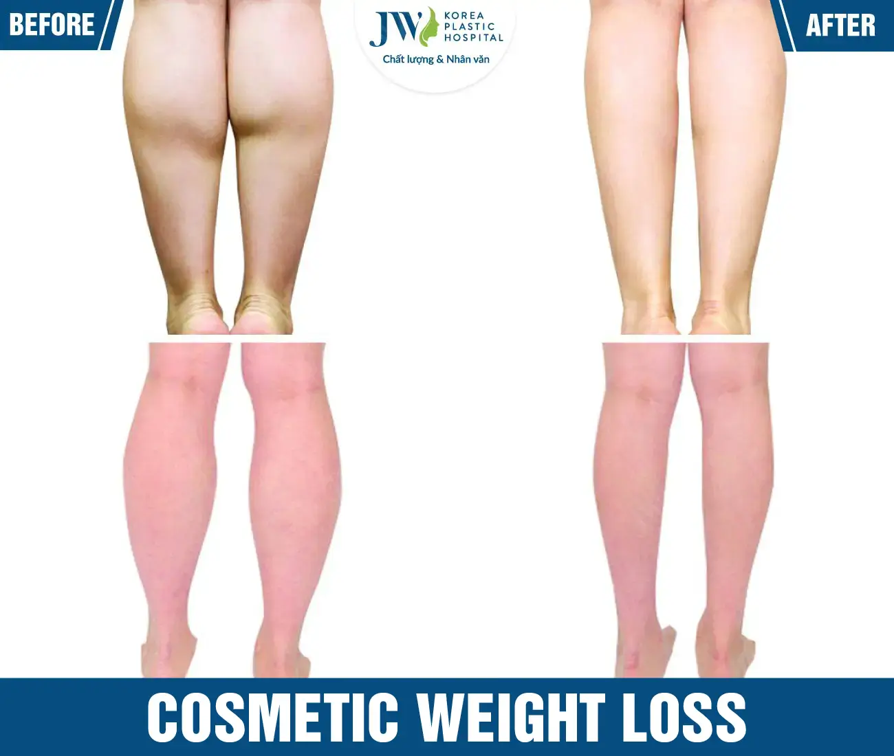Cosmetic weight loss
